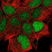 Anti-CCDC106 antibody produced in rabbit Prestige Antibodies® Powered by Atlas Antibodies, affinity isolated antibody, buffered aqueous glycerol solution
