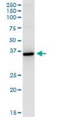 Monoclonal Anti-HSD11B1 antibody produced in mouse clone 2C10, ascites fluid
