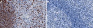 Anti-Lck Antibody, clone 2B20 ZooMAb® Rabbit Monoclonal recombinant, expressed in HEK 293 cells