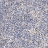 Anti-EOMES antibody produced in rabbit Prestige Antibodies® Powered by Atlas Antibodies, affinity isolated antibody, buffered aqueous glycerol solution