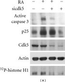 Anti-Cdk5 Antibody, clone DC17 clone DC17, Upstate®, from mouse