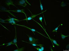 Py2T Mouse Mammary Tumor Cell Line