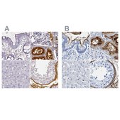 Anti-DPEP1 antibody produced in rabbit Prestige Antibodies® Powered by Atlas Antibodies, affinity isolated antibody, buffered aqueous glycerol solution
