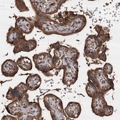 Anti-PIK3C2A antibody produced in rabbit Prestige Antibodies® Powered by Atlas Antibodies, affinity isolated antibody, buffered aqueous glycerol solution