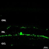Anti-Vesicular Nucleotide Transporter (VNUT Antibody) serum, from guinea pig