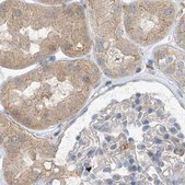 Anti-NAGK antibody produced in rabbit Prestige Antibodies® Powered by Atlas Antibodies, affinity isolated antibody, buffered aqueous glycerol solution
