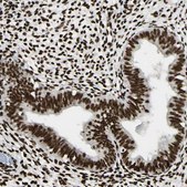 Anti-FUS antibody produced in rabbit Prestige Antibodies® Powered by Atlas Antibodies, affinity isolated antibody, buffered aqueous glycerol solution