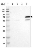 Anti-CYP4F11 antibody produced in rabbit Prestige Antibodies® Powered by Atlas Antibodies, affinity isolated antibody, buffered aqueous glycerol solution
