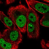 Anti-LRRC41 antibody produced in rabbit Prestige Antibodies® Powered by Atlas Antibodies, affinity isolated antibody, buffered aqueous glycerol solution
