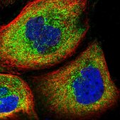 Anti-WDR34 antibody produced in rabbit Prestige Antibodies® Powered by Atlas Antibodies, affinity isolated antibody, buffered aqueous glycerol solution