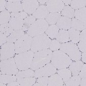 Anti-SCML2 antibody produced in rabbit Prestige Antibodies® Powered by Atlas Antibodies, affinity isolated antibody