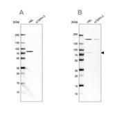 Anti-BTK antibody produced in rabbit Ab1, Prestige Antibodies® Powered by Atlas Antibodies, affinity isolated antibody, buffered aqueous glycerol solution