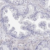 Anti-ENO4 antibody produced in rabbit Prestige Antibodies® Powered by Atlas Antibodies, affinity isolated antibody, buffered aqueous glycerol solution