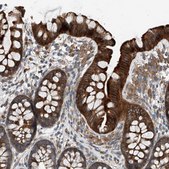 Anti-HOXA5 antibody produced in rabbit Prestige Antibodies® Powered by Atlas Antibodies, affinity isolated antibody, buffered aqueous glycerol solution