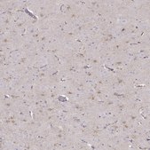 Anti-SLC6A17 antibody produced in rabbit Prestige Antibodies® Powered by Atlas Antibodies, affinity isolated antibody, buffered aqueous glycerol solution
