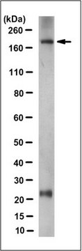 Anti-Nephrin Antibody, clone 3B6.1 clone 3B6.1, from mouse