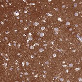 Anti-NCAM1 antibody produced in rabbit Prestige Antibodies® Powered by Atlas Antibodies, affinity isolated antibody, buffered aqueous glycerol solution