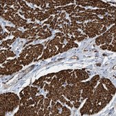 Anti-GARNL3 antibody produced in rabbit Prestige Antibodies® Powered by Atlas Antibodies, affinity isolated antibody, buffered aqueous glycerol solution