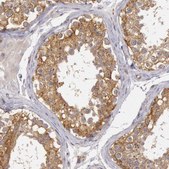 Anti-NMT2 antibody produced in rabbit Prestige Antibodies® Powered by Atlas Antibodies, affinity isolated antibody, buffered aqueous glycerol solution