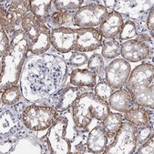 Anti-EPB41L3 antibody produced in rabbit Prestige Antibodies® Powered by Atlas Antibodies, affinity isolated antibody, buffered aqueous glycerol solution