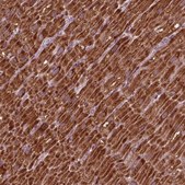 Anti-NDUFB10 antibody produced in rabbit Prestige Antibodies® Powered by Atlas Antibodies, affinity isolated antibody