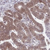 Anti-COPS6 antibody produced in rabbit Prestige Antibodies® Powered by Atlas Antibodies, affinity isolated antibody, buffered aqueous glycerol solution