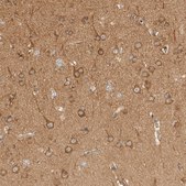 Anti-RABEP1 antibody produced in rabbit Prestige Antibodies® Powered by Atlas Antibodies, affinity isolated antibody, buffered aqueous glycerol solution, Ab2