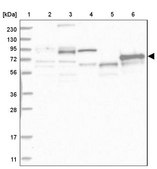Anti-ABLIM2 antibody produced in rabbit Prestige Antibodies® Powered by Atlas Antibodies, affinity isolated antibody, buffered aqueous glycerol solution