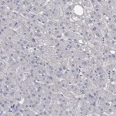 Anti-LRFN4 antibody produced in rabbit Prestige Antibodies® Powered by Atlas Antibodies, affinity isolated antibody, buffered aqueous glycerol solution