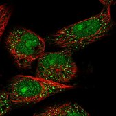 Anti-TOX4 antibody produced in rabbit Prestige Antibodies® Powered by Atlas Antibodies, affinity isolated antibody, buffered aqueous glycerol solution