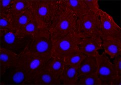 Anti-γ-Actin antibody, Mouse monoclonal clone 2-2.1.14.17, purified from hybridoma cell culture