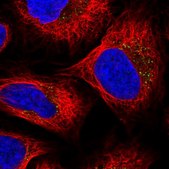 Anti-SULT2B1 antibody produced in rabbit Prestige Antibodies® Powered by Atlas Antibodies, affinity isolated antibody, buffered aqueous glycerol solution