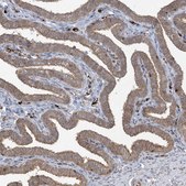 Anti-ABCF3 antibody produced in rabbit Prestige Antibodies® Powered by Atlas Antibodies, affinity isolated antibody, buffered aqueous glycerol solution
