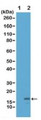 Anti-acetyl-Histone H3 (Lys18) Antibody, clone RM166 clone RM166, from rabbit