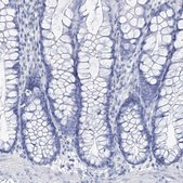 Anti-NKX6-1 antibody produced in rabbit Prestige Antibodies® Powered by Atlas Antibodies, affinity isolated antibody, buffered aqueous glycerol solution
