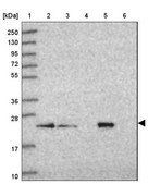 Anti-SAR1B antibody produced in rabbit Prestige Antibodies® Powered by Atlas Antibodies, affinity isolated antibody, buffered aqueous glycerol solution