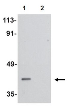 Anti-PPAPDC2 Antibody from rabbit, purified by affinity chromatography