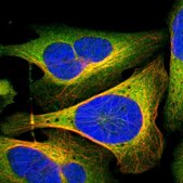 Anti-DPYSL2 antibody produced in rabbit Prestige Antibodies® Powered by Atlas Antibodies, affinity isolated antibody, buffered aqueous glycerol solution