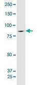 Anti-SUPV3L1 antibody produced in mouse IgG fraction of antiserum, buffered aqueous solution
