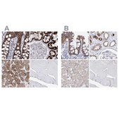 Anti-HIBCH antibody produced in rabbit Prestige Antibodies® Powered by Atlas Antibodies, affinity isolated antibody, buffered aqueous glycerol solution