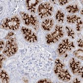 Anti-SLC3A1 antibody produced in rabbit Prestige Antibodies® Powered by Atlas Antibodies, affinity isolated antibody, buffered aqueous glycerol solution