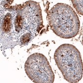 抗LGALS3BP抗体 ウサギ宿主抗体 Prestige Antibodies® Powered by Atlas Antibodies, affinity isolated antibody, buffered aqueous glycerol solution