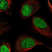Anti-RSBN1 antibody produced in rabbit Prestige Antibodies® Powered by Atlas Antibodies, affinity isolated antibody, buffered aqueous glycerol solution