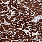 Anti-MYBPC3 antibody produced in rabbit Prestige Antibodies® Powered by Atlas Antibodies, affinity isolated antibody, buffered aqueous glycerol solution