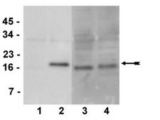 Anti-phospho-CENP-A (Ser7) Antibody, clone NL41, rabbit monoclonal culture supernatant, clone NL41, Upstate®