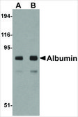 Anti-Albumin antibody produced in chicken affinity isolated antibody, buffered aqueous solution