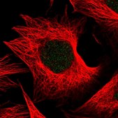 Anti-THAP5 antibody produced in rabbit Prestige Antibodies® Powered by Atlas Antibodies, affinity isolated antibody