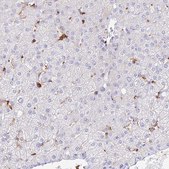 Anti-DENND1C antibody produced in rabbit Prestige Antibodies® Powered by Atlas Antibodies, affinity isolated antibody, buffered aqueous glycerol solution