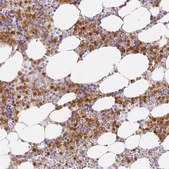 Anti-HK3 antibody produced in rabbit Prestige Antibodies® Powered by Atlas Antibodies, affinity isolated antibody, buffered aqueous glycerol solution