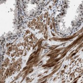 Anti-CRTC1 antibody produced in rabbit affinity isolated antibody, buffered aqueous glycerol solution